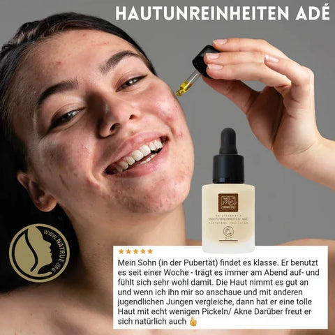 HAUTUNREINHEITEN ADÉ - Klärendes Hautserum mit Hyaluron 15ml BIO-Naturkosmetik - VITALOVE - Naturprodukte