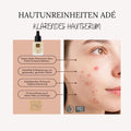 HAUTUNREINHEITEN ADÉ - Klärendes Hautserum mit Hyaluron 15ml BIO-Naturkosmetik - VITALOVE - Naturprodukte